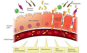 illustration för läckande tarm