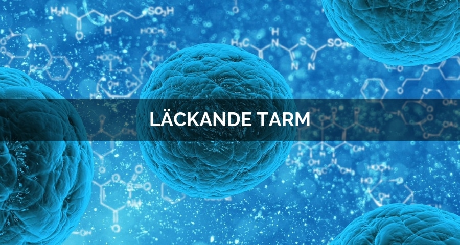 10 tecken på läckande tarm – och hur du läker dig från det