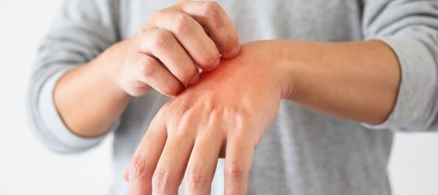 Bli av med histaminintolerans med hjälp av AIP